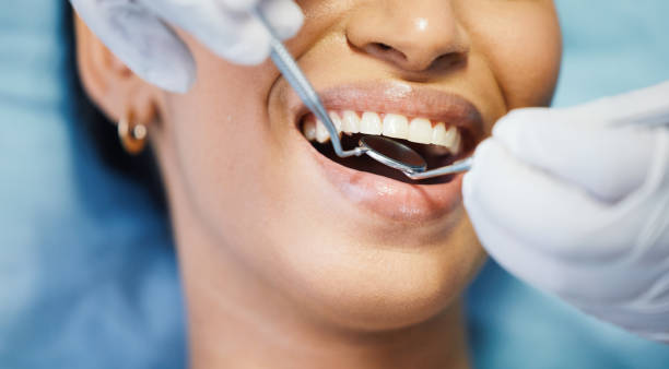 Best Urgent Tooth Repair  in Rendon, TX
